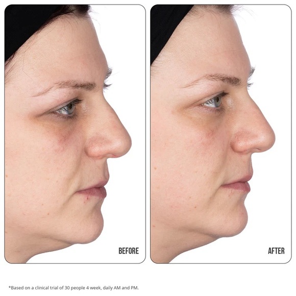 NIP + FAB Vit C Fix Eye Cream 10% - Picture 7 of 7